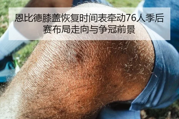 恩比德膝盖恢复时间表牵动76人季后赛布局走向与争冠前景